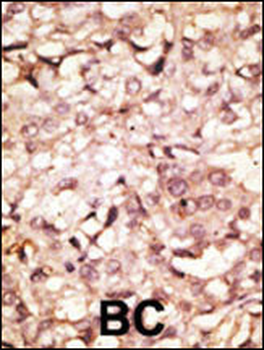 ACE2 (SARS Receptor) Antibody (C-term)