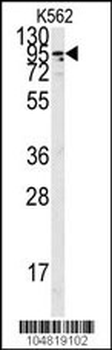 ACE2 (SARS Receptor) Antibody (C-term)