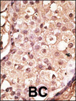 ACE2 (SARS Receptor) Antibody (Center)
