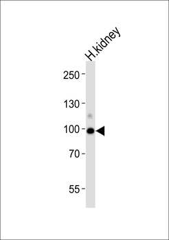ACE2 (SARS Receptor) Antibody (Center)