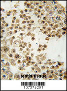 ACE2 (SARS Receptor) Antibody (N-term)