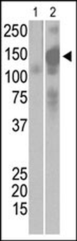 SARS virus Sm Antibody