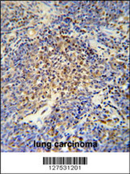 OTUD4 Antibody (N-term)