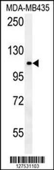 OTUD4 Antibody (N-term)