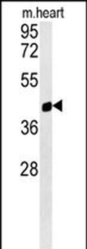 PTGR1 Antibody (Center)