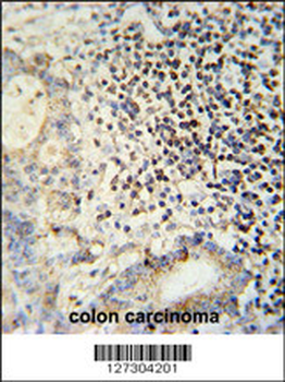 ESRP1 Antibody (N-term)