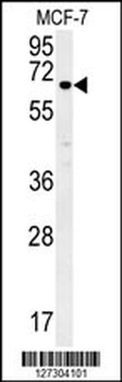 ESRP1 Antibody (N-term)