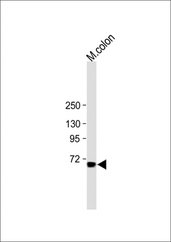 ESRP1 Antibody (N-term)