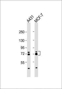 ESRP1 Antibody (N-term)