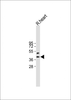 HEY2 Antibody (N-term)