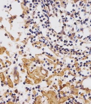CUX1 Antibody (C-term)