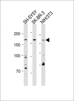 CUX1 Antibody (C-term)