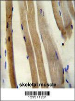 CS Antibody (N-term)