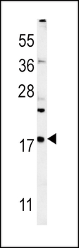 VAMP4 Antibody (Center)