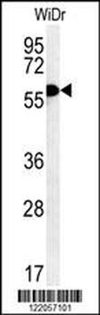 TANK Antibody (Center)