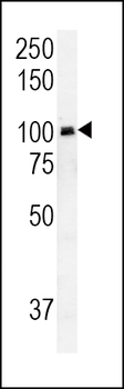 RASGRP1 Antibody (Center)