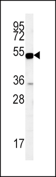 SLC9A3R1 Antibody (Center)