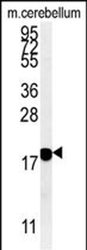 SNCB Antibody (C-term)