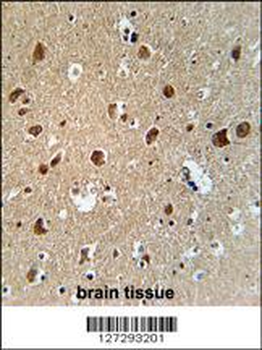 AFTPH Antibody (C-term)