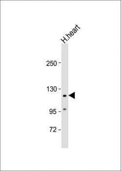 VLDLR Antibody (Center)