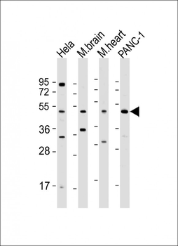 WNT5A Antibody (Center)