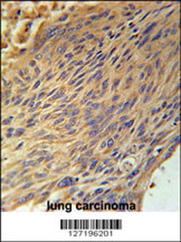 CPEB4 Antibody (N-term)