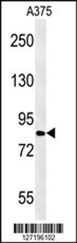 CPEB4 Antibody (N-term)