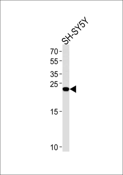 REG3G Antibody (Center)
