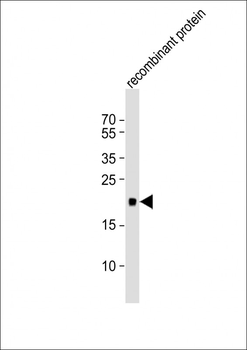 REG3G Antibody (Center)
