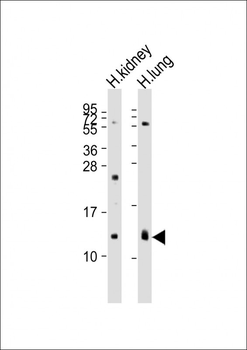 REG3G Antibody (Center)