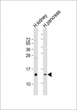 REG3G Antibody (Center)