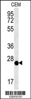 CRISPLD2 Antibody (N-term)