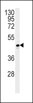 ADH1C Antibody (Center)