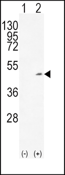 ADH1C Antibody (Center)