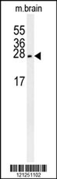 PMCH Antibody (Center)