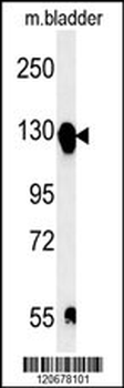 ITGA5 Antibody (C-term)