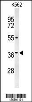 GLP1 Antibody (Center)