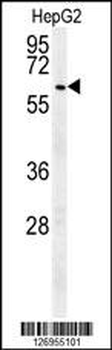 USP17L24 Antibody (C-term)