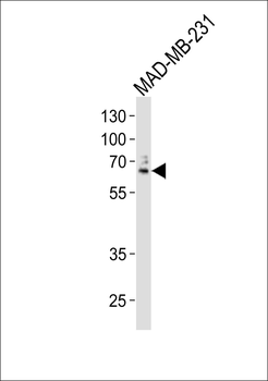 USP17L24 Antibody (C-term)
