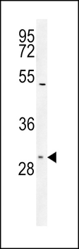 TXTP Antibody (Center)