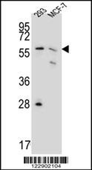PGD Antibody (Center)