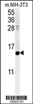 CRABP1 Antibody (C-term)