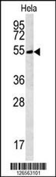TRMT11 Antibody (C-term)