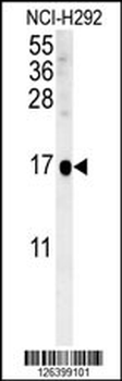 SIKE Antibody (C-term)