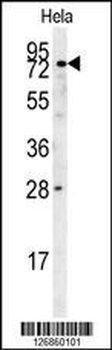 IDUA Antibody (Center)