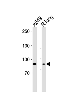 IDUA Antibody (Center)