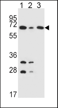 DLAT Antibody (C-term)