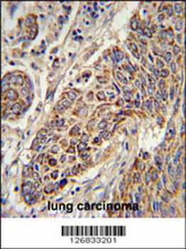 CYC1 Antibody (C-term)
