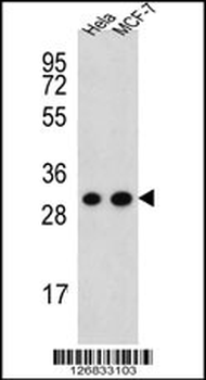 CYC1 Antibody (C-term)