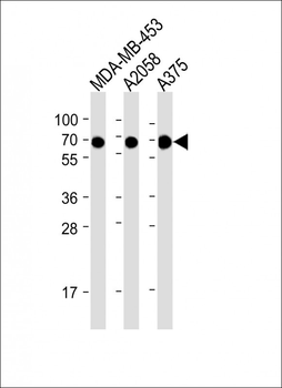 CD63 Antibody (C-term)